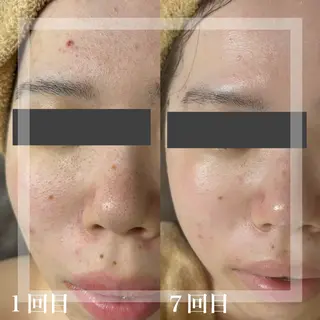 WHITE AQUA 北千住店のエステ・リラクイメージ