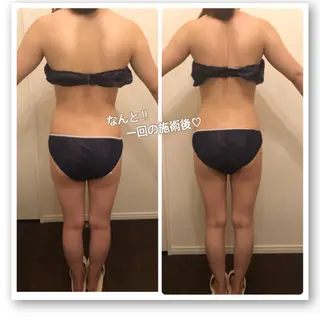 FLEUR大阪・美容 整体・痩身・小顔のエステ・リラクイメージ