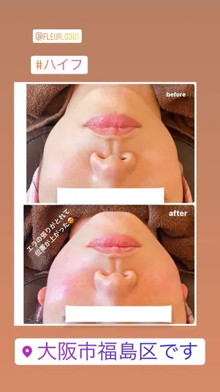 FLEUR大阪・整体 ・ハイフ・痩身・小顔のエステ・リラクイメージ
