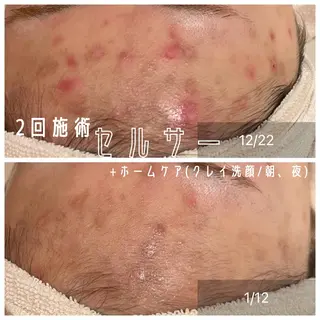 CHERIE所属・CHERIE Hisadaのエステ・リラクイメージ