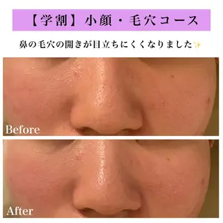 Bellesthe (ベルエステ)のエステ・リラクイメージ