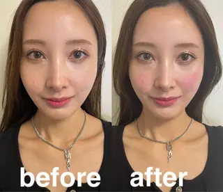 美容鍼灸サロン mahoroba院長のエステ・リラクイメージ