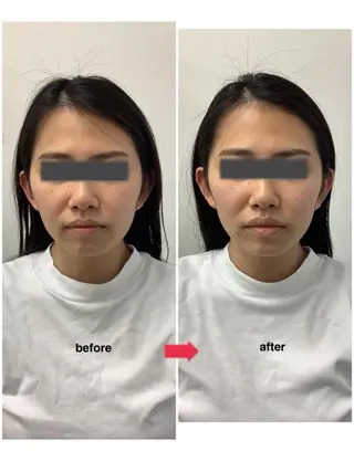 メディカルサロンドオフ所属・ハリサロンドオフ 美容鍼灸×小顔整体のエステ・リラクイメージ