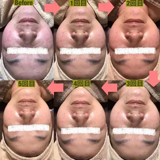 エステサロン Lilasmileのエステ・リラクイメージ