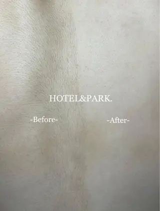 HOTEL&PARK . ワックス脱毛のエステ・リラクイメージ