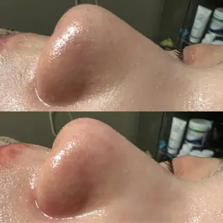 lymph care 'Welnəsのエステ・リラクイメージ