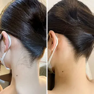 うなじ脱毛/美肌脱毛 LABELのエステ・リラクイメージ