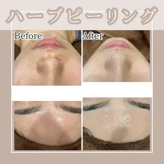 メンズ Amaryllis 🌹松本のエステ・リラクイメージ