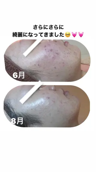 【足圧】鬼👹リンパ 身体整うサロンのエステ・リラクイメージ