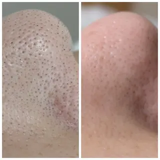 自然由来スキンケア/ 肌質改善/まつパのエステ・リラクイメージ