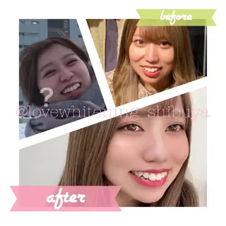 LOVE ホワイトニング渋谷のその他イメージ