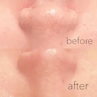 眉毛×肌質改善🫧 高岳/新栄町✨YUUの眉毛・アイブロウイメージ