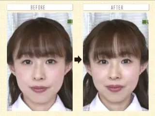 むくみたるみ専門☆ 美容鍼・小顔矯正のエステ・リラクイメージ