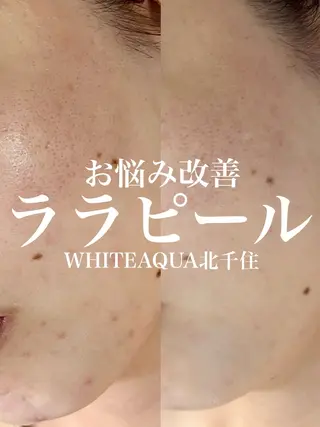 WHITE AQUA 北千住店のエステ・リラクイメージ