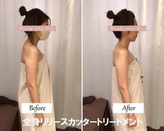 痩身×フェイシャル ブライダル|Linoのエステ・リラクイメージ