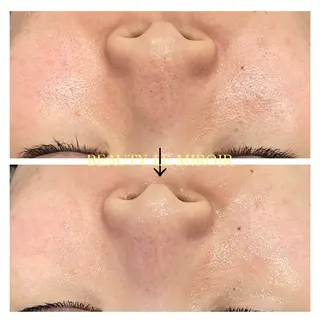 ビューティー ミロワールのエステ・リラクイメージ