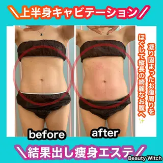 痩身/脱毛/ネイル HARUKAのエステ・リラクイメージ