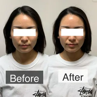 脱毛専門サロン BELFINE恵比寿のエステ・リラクイメージ