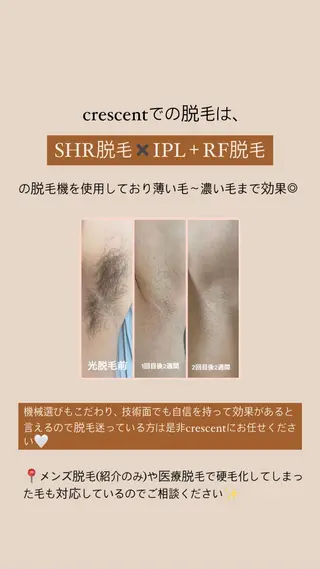 crescent所属・【韓国肌管理・脱毛】 クレセントのエステ・リラクイメージ