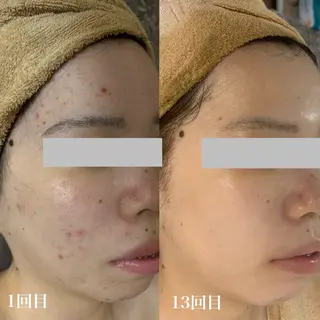 WHITE AQUA 北千住店のエステ・リラクイメージ