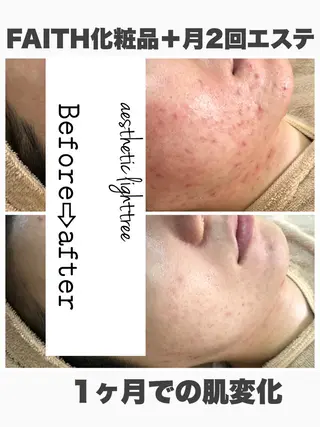 ロング カラー パーマ ヘアアレンジ メンズ キッズ ネイル マツエク・マツパ ニキビ&跡改善サロン オーナー光木のエステ・リラクイメージ