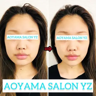 小顔美容鍼専門サロン 渋谷YZのエステ・リラクイメージ