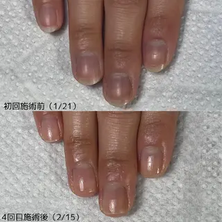 ネイル nail 1623のネイルデザイン