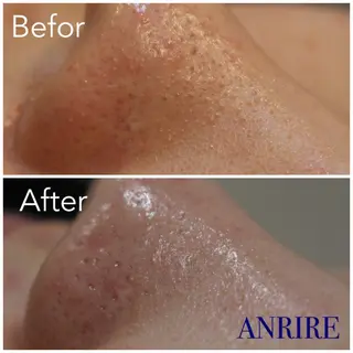 ANRIRE (アンリール)のエステ・リラクイメージ