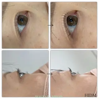 マツエク・マツパ ビューティー ミロワールのエステ・リラクイメージ