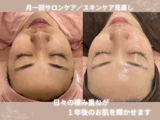 【現役看護師】高来 笑子のエステ・リラクイメージ