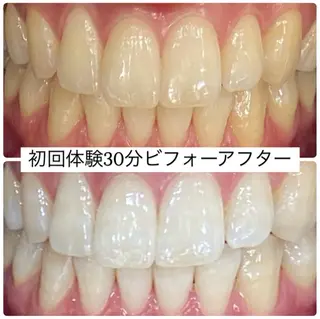 PLATINUM Beauty 横浜店所属・ホワイトニングルーム 横浜店のその他イメージ