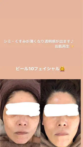 リヴァージュ rivageのマツエク・マツパデザイン