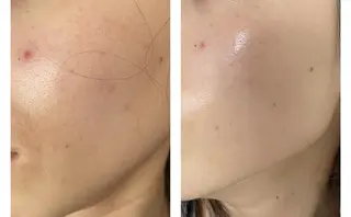 👑Linolaby RAYVIS👑⭐️のエステ・リラクイメージ