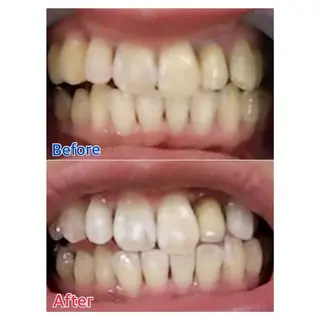 MBEAUTYSALON 千葉店・京成大久保所属・Melty 輝のその他イメージ