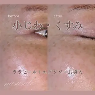 肌質改善フェイシャル 看護師 只野のエステ・リラクイメージ