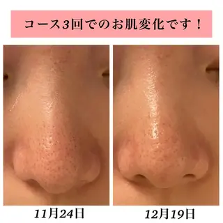 Bellesthe (ベルエステ)のエステ・リラクイメージ