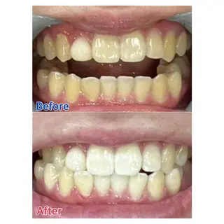 MBEAUTYSALON 千葉店・京成大久保所属・Melty 輝のその他イメージ