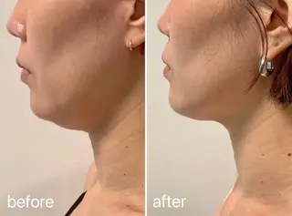 スキンケアサロン　デディア所属・米谷🎀 デディア恵比寿🪞✨のエステ・リラクイメージ