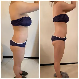 FLEUR大阪・整体 ・ハイフ・痩身・小顔のエステ・リラクイメージ