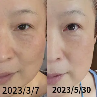 自然由来スキンケア/ 肌質改善/まつパのエステ・リラクイメージ