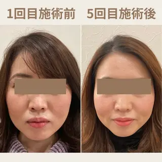 Ayaka🤍 恵比寿/美容鍼/整体のエステ・リラクイメージ