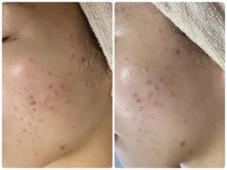 De I'm トータルビューティーサロン所属・COCO beautyサロンのエステ・リラクイメージ