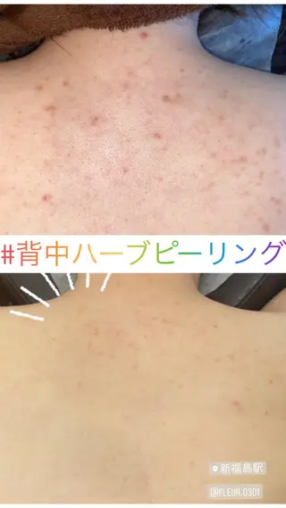 FLEUR大阪・整体 ・ハイフ・痩身・小顔のエステ・リラクイメージ