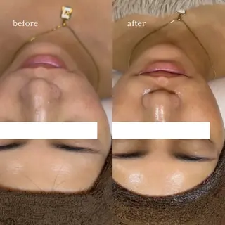 EARNEST大阪 心斎橋【韓国肌管理】のエステ・リラクイメージ