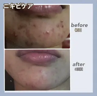 RAYVIS 郡山店のエステ・リラクイメージ