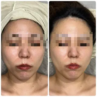 脱毛&フェイシャル 専門店muro.のエステ・リラクイメージ