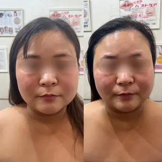 毛穴改善/脱毛 ネイル 川上久仁子のエステ・リラクイメージ