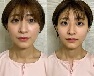 美容鍼灸サロン mahoroba院長のエステ・リラクイメージ