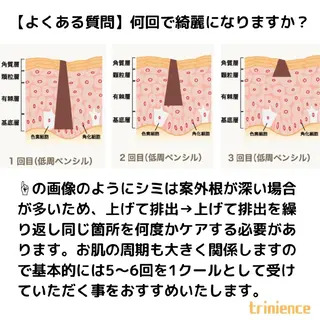 シミケア・肌改善専門 トリニエンス浦和店のエステ・リラクイメージ