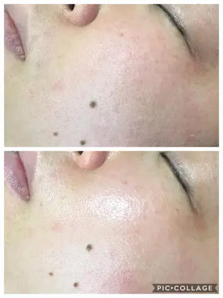 ヒーリングサロン メリッサ/tooSMILE所属・大屋 詩織のエステ・リラクイメージ